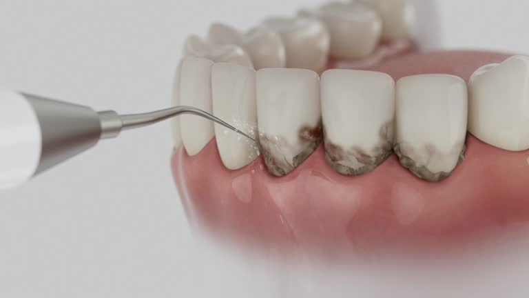 Reliable Dental contractor in Murphys, CA by Smile Center Dentistry
